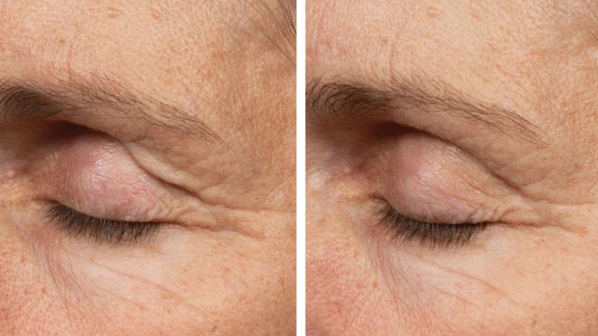 before-after-2-1200w