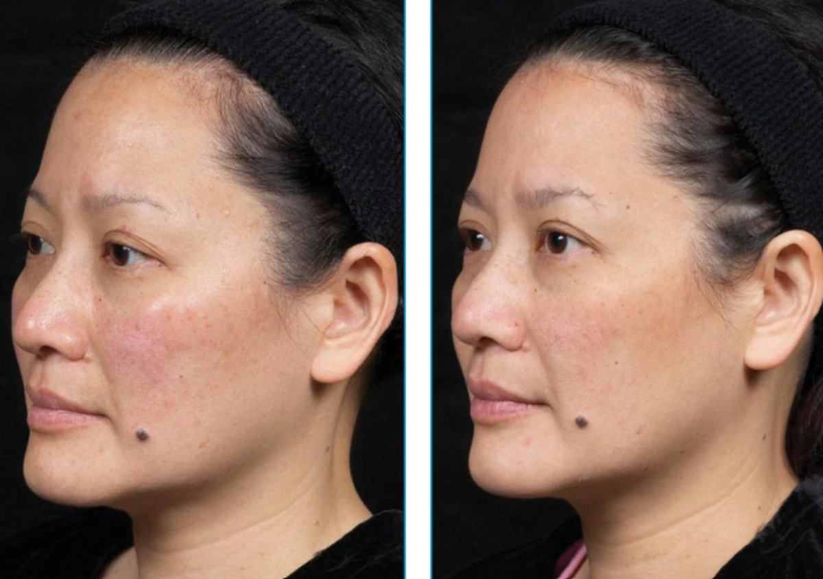 before-after-set2-07-1200w