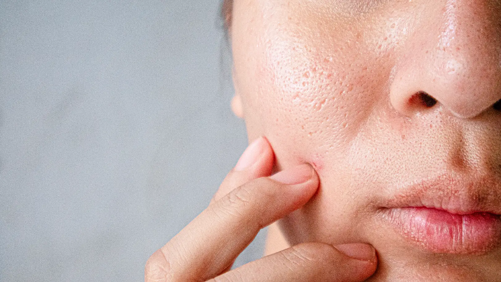 Close-up of a person pressing their cheek, showing visible pores and uneven texture around the nose and cheek.