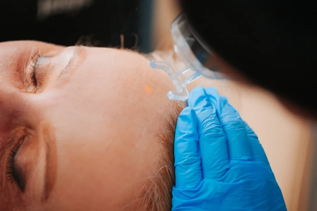 Gloved hand holds a clear guide against a woman’s cheek marked with a fine grid and orange light.