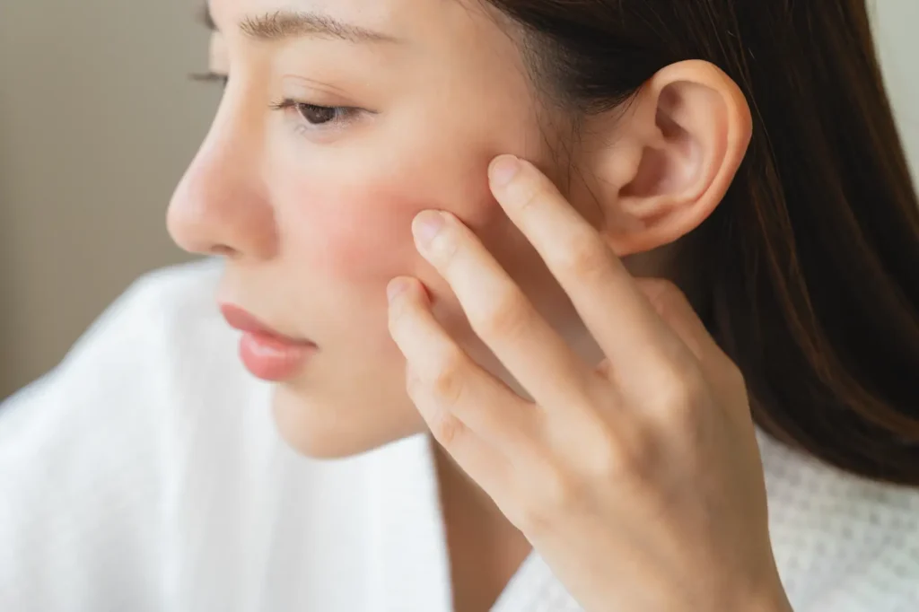 Woman touches her cheek where a diffuse red patch is visible below the cheekbone.